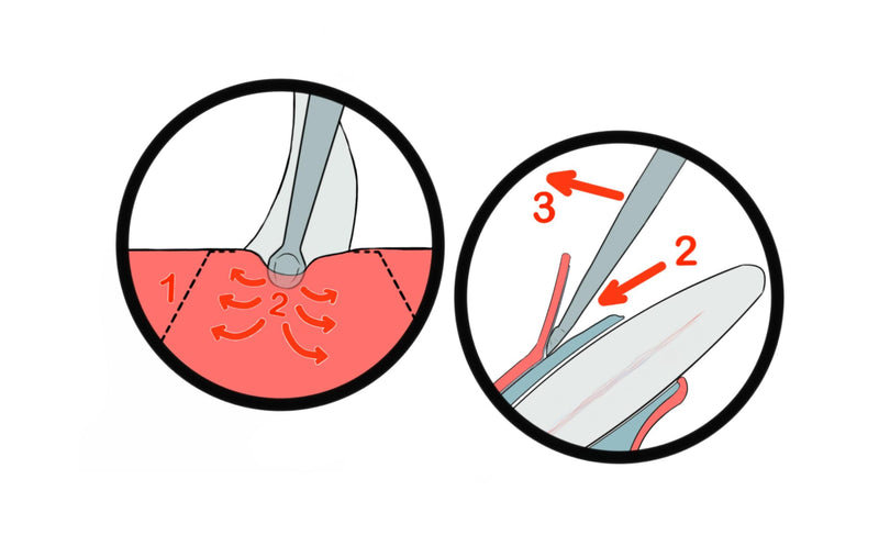 DENTANOMIC Periostikärjet | eri kokoja