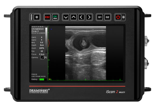 DRAMIŃSKI iScan2 Multi ultraäänitutkimuslaite (ilman antureita)