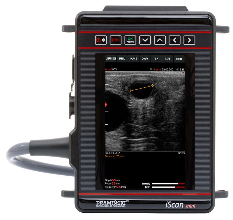 DRAMIŃSKI iScan mini ultraäänitutkimuslaite (lineaari rektaali)