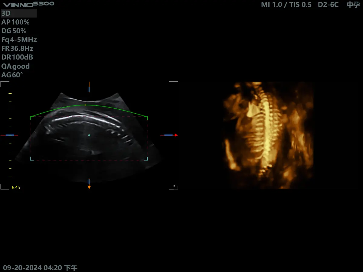 VINNO S300Vet Ultraäänitutkimuslaite