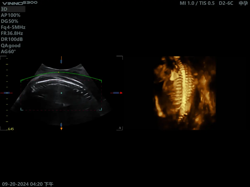 VINNO S300Vet Ultraäänitutkimuslaite