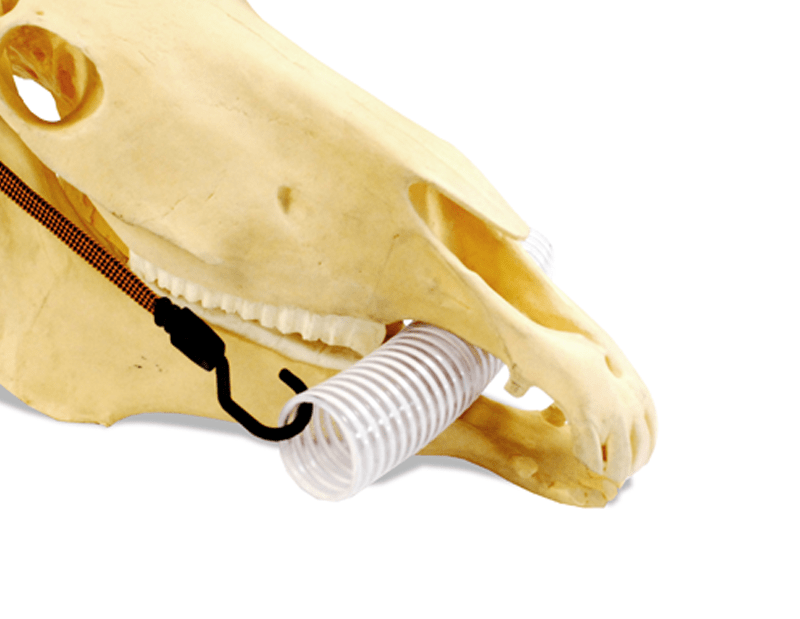 Suunavaaja etuhampaille