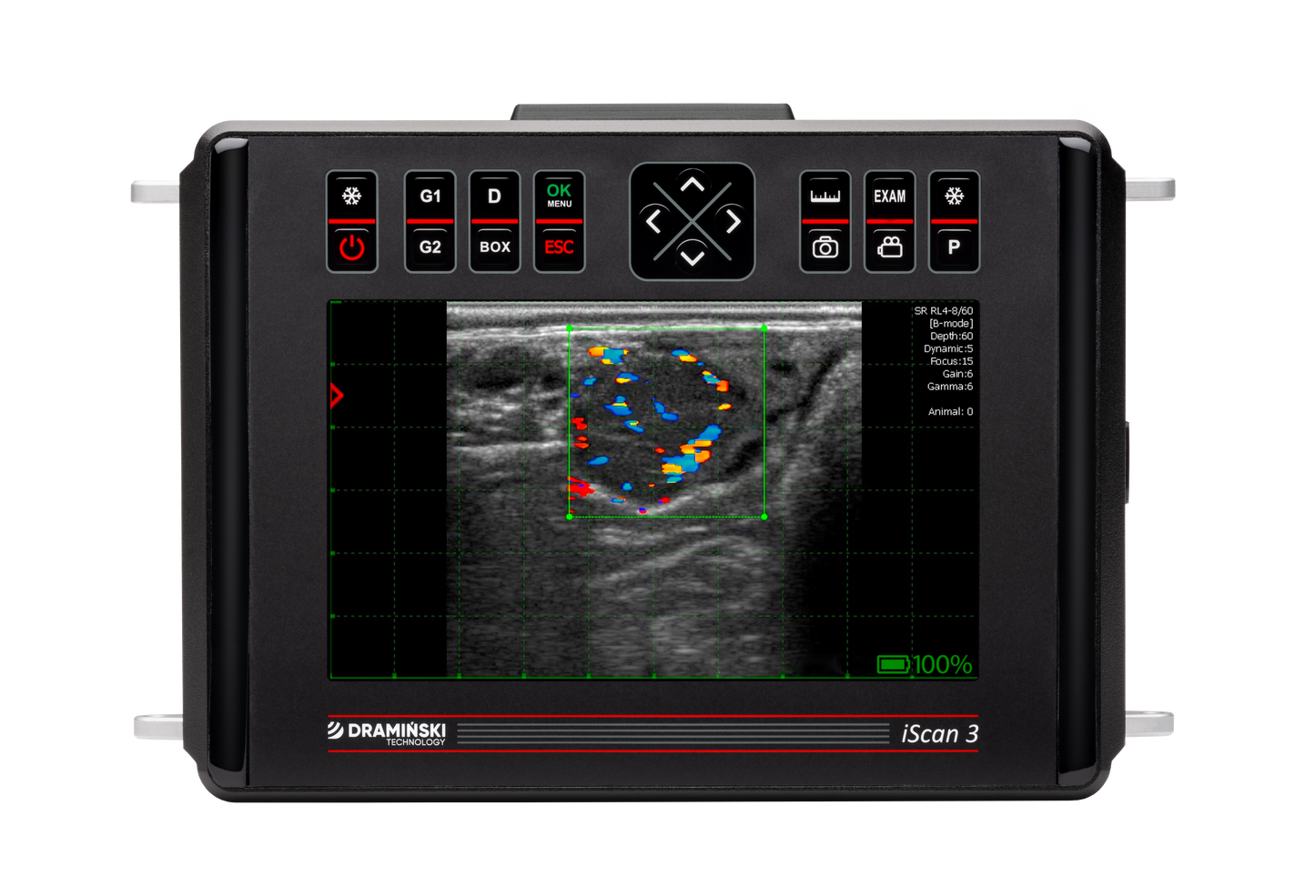 DRAMIŃSKI iScan3 ultraäänitutkimuslaite (ilman antureita)