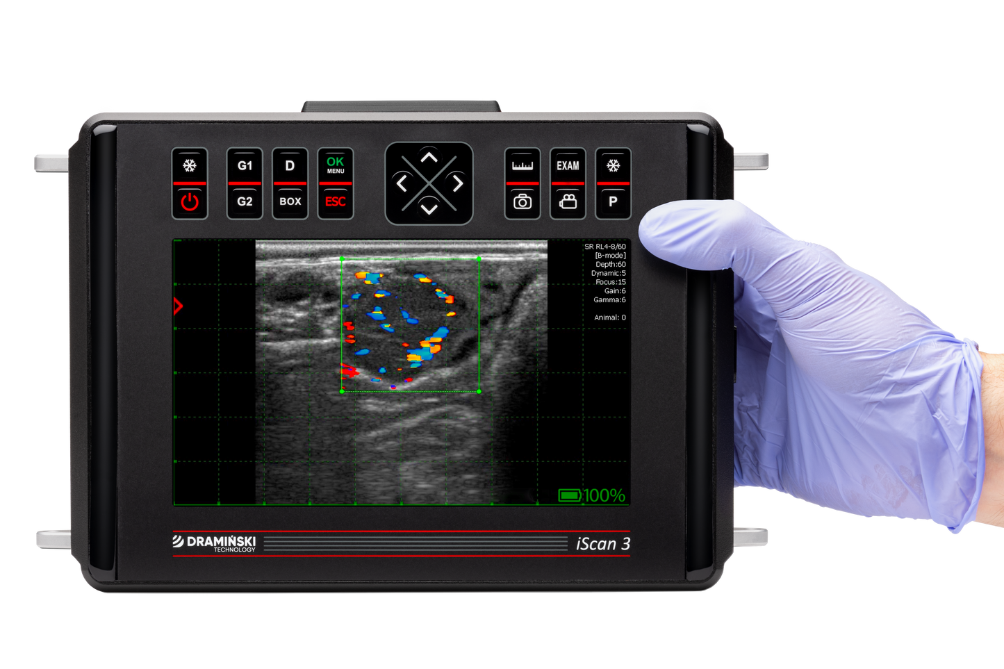 DRAMIŃSKI iScan3 ultraäänitutkimuslaite (ilman antureita)