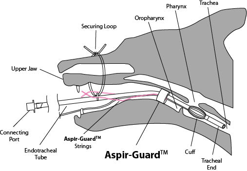 Aspir-Guard 9 piece pack